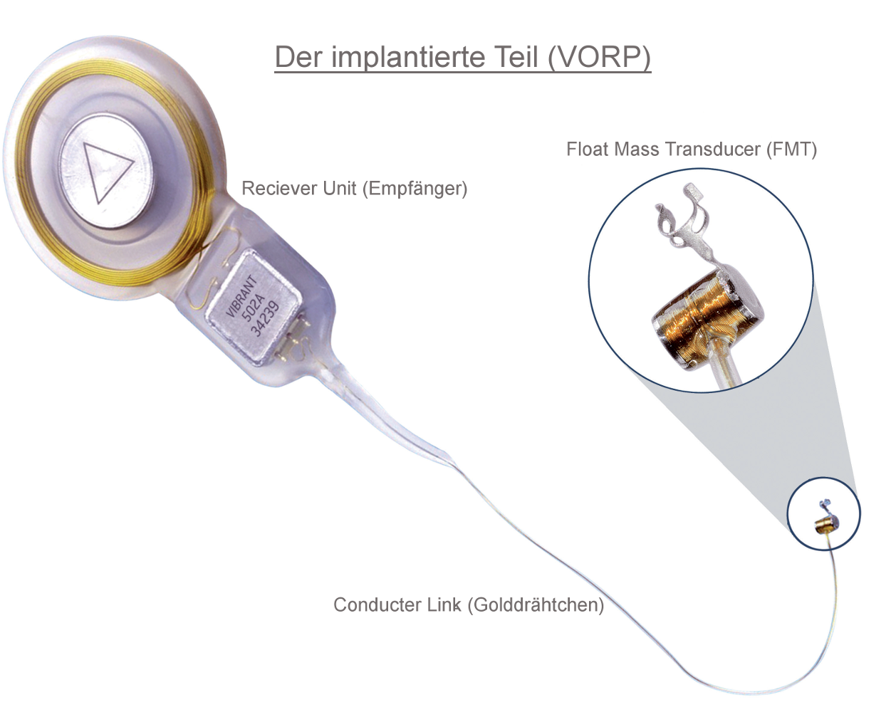 Die implantierte Komponente (VORP)